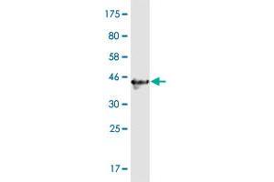 Western Blotting (WB) image for anti-Coiled-Coil Domain Containing 115 (CCDC115) (AA 1-132) antibody (ABIN529660)