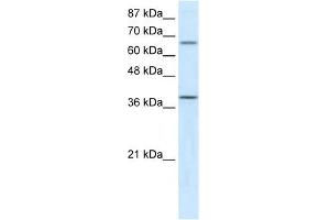 ACADM antibody used at 5 ug/ml to detect target protein. (Medium-Chain Specific Acyl-CoA Dehydrogenase, Mitochondrial (N-Term) 抗体)