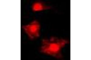 Immunofluorescent analysis of FAST Kinase staining in HL60 cells. (FASTK 抗体  (Center))