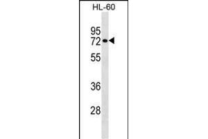 RHOT2 Antibody (Center) (ABIN1538254 and ABIN2848958) western blot analysis in HL-60 cell line lysates (35 μg/lane). (RHOT2 抗体  (AA 291-320))