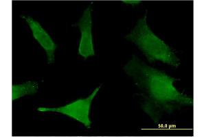 Immunofluorescence of monoclonal antibody to SLC6A16 on HeLa cell. (SLC6A16 抗体  (AA 406-492))