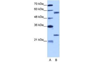 Copine I antibody used at 5 ug/ml to detect target protein. (CPNE1 抗体  (N-Term))