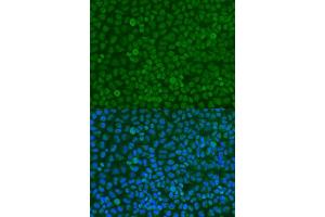 Immunofluorescence analysis of U2OS cells using YWHAZ antibody. (14-3-3 zeta 抗体  (C-Term))