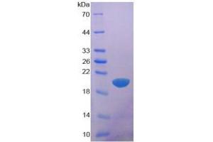 SDS-PAGE analysis of Human Glypican 1 Protein. (GPC1 蛋白)