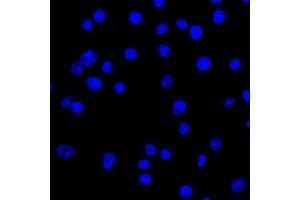 Confocal Immunofluorescent analysis of Ramos cells using CF488-labeled Isotype Control Monoclonal Antibody (IgG2a) (Green). (IgL 抗体  (CF®488A))