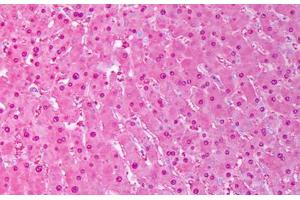 Anti-SOD1 antibody IHC staining of human liver, hephatocytes. (SOD1 抗体)