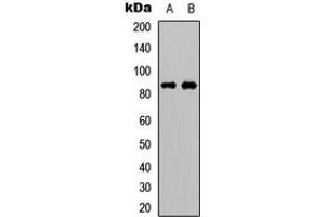 Western blot analysis of FRS2 (pY436) expression in Jurkat (A), Huvec (B) whole cell lysates. (FRS2 抗体  (C-Term, pTyr436))