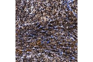 Immunohistochemistry (IHC) image for anti-TH1-Like (TH1L) (AA 355-599) antibody (ABIN1683024)