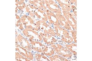 Immunohistochemistry of paraffin-embedded human stomach using HMGA1 antibody. (HMGA1 抗体)
