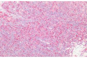 Immunohistochemistry (IHC) image for anti-Protein tyrosine Phosphatase, Non-Receptor Type 2 (PTPN2) (AA 1-257) antibody (ABIN7444958)