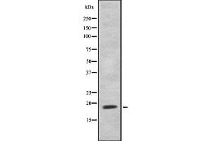 Western blot analysis of HEN1/2 using Jurkat whole cell lysates (HEN1/2 抗体)
