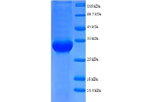 SDS-PAGE (SDS) image for Ribosomal Protein L35 (RPL35) (AA 7-64), (partial) protein (GST tag) (ABIN5712618) (RPL35 Protein (AA 7-64, partial) (GST tag))