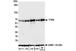 Western Blotting (WB) image for anti-Transcription Factor EB (TFEB) (C-Term) antibody (ABIN7795623)