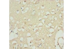 Immunohistochemistry of paraffin-embedded human brain tissue using ABIN7175594 at dilution of 1:100 (CACNB1 抗体  (AA 429-598))