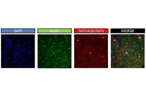 Sample Type:  mouse brain   Dilution: dilution 1:2000