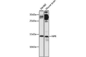 Western blot analysis of extracts of various cell lines, using NPB antibody (ABIN7268885) at 1:1000 dilution. (Neuropeptide B 抗体  (AA 1-125))