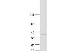 Validation with Western Blot