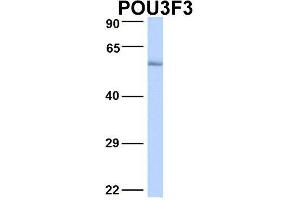 Host:  Rabbit  Target Name:  POU3F3  Sample Type:  Human Fetal Lung  Antibody Dilution:  1. (POU3F3 抗体  (N-Term))