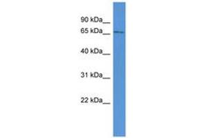 Image no. 1 for anti-Amyloid beta (A4) Precursor Protein-Binding, Family B, Member 1 Interacting Protein (APBB1IP) (AA 38-87) antibody (ABIN6746504) (Amyloid beta (A4) Precursor Protein-Binding, Family B, Member 1 Interacting Protein (APBB1IP) (AA 38-87) 抗体)