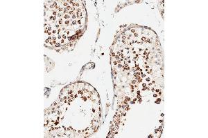 Immunohistochemistry (Paraffin-embedded Sections) (IHC (p)) image for anti-Voltage-Dependent Anion Channel 3 (VDAC3) (AA 156-183) antibody (ABIN1537893)
