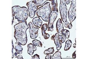 IHC analysis of VAPA using anti-VAPA antibody (ABIN7603249). (VAPA 抗体  (N-Term))