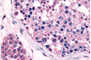 Human Testis (formalin-fixed, paraffin-embedded) stained with GPR18 antibody ABIN213453 at 5 ug/ml followed by biotinylated goat anti-rabbit IgG secondary antibody ABIN481713, alkaline phosphatase-streptavidin and chromogen. (GPR18 抗体  (Cytoplasmic Domain))