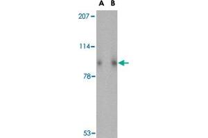 Western blot analysis of SLITRK1 in human brain tissue lysate with SLITRK1 polyclonal antibody  at (A) 1 and (B) 2 ug/mL . (SLITRK1 抗体  (Internal Region))