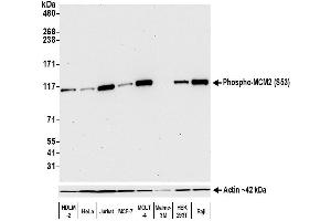 Western Blotting (WB) image for anti-Minichromosome Maintenance Complex Component 2 (MCM2) (pSer53) antibody (ABIN7449430) (Recombinant MCM2 抗体  (pSer53))