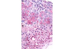 Immunohistochemical staining of formalin-fixed paraffin-embedded human lung (A) and human testis (B) with nMBR polyclonal antibody . (NMBR 抗体  (Cytoplasmic Domain))