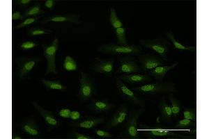 Immunofluorescence of purified MaxPab antibody to WDR79 on HeLa cell. (WRAP53 抗体  (AA 1-548))