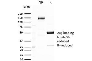 SDS-PAGE Analysis Purified GLUT-1 Recombinant Rabbit Monoclonal Antibody (GLUT1/3132R). (Recombinant GLUT1 抗体  (AA 203-305))