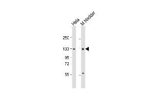 All lanes : Anti-Enpp1 Antibody (N-term) at 1:1000 dilution Lane 1: Hela whole cell lysate Lane 2: mouse bladder lysate Lysates/proteins at 20 μg per lane. (ENPP1 抗体  (N-Term))