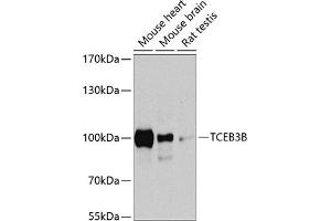 Western Blotting (WB) image for anti-Transcription Elongation Factor B Polypeptide 3B (Elongin A2) (TCEB3B) (AA 534-753) antibody (ABIN6148940)