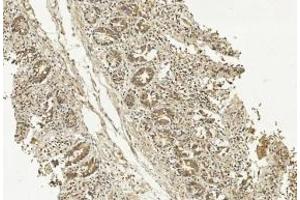 Immunohistochemical analysis of paraffin-embedded Human Small intestine section using Pink1 (ABIN1539798 and ABIN2843775). (METAP1 抗体)