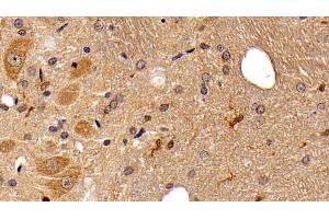Detection of IBA1 in Rat Cerebellum Tissue using Monoclonal Antibody to Ionized Calcium-binding Adapter Molecule 1 (IBA1)