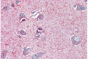Brain, cortex, Human: Formalin-Fixed, Paraffin-Embedded (FFPE) (NTSR2 抗体  (Internal Region))