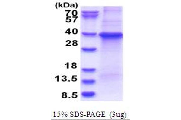 GNB1 Protein (AA 1-340) (His tag)
