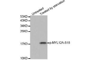Western blot analysis of extracts from 293 cells untreated or treated with starvation using Phospho-MYL12A-S18 antibody. (MYL12A 抗体  (pSer18))