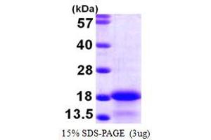 SDS-PAGE (SDS) image for Myosin Light Chain 6, Alkali, Smooth Muscle and Non Muscle (MYL6) (AA 1-151) protein (His tag) (ABIN667886)