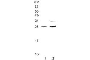 Western blot testing of rat 1) PC-12 and 2) RH35 lysate with Betacellulin antibody at 0. (Betacellulin 抗体)