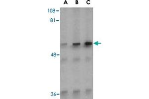 Western blot analysis of Irak2 in A-20 whole cell lysate with Irak2 polyclonal antibody  at (A) 0. (IRAK2 抗体  (C-Term))