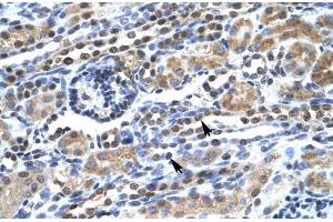 Human kidney; SUPT5H antibody - C-terminal region in Human kidney cells using Immunohistochemistry (SUPT5H 抗体  (C-Term))