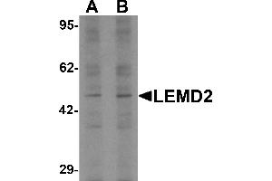 Western blot analysis of LEMD2 in 293 cell lysate with LEMD2 antibody at (A) 1 and (B) 2 µg/mL. (LEMD2 抗体  (Middle Region))