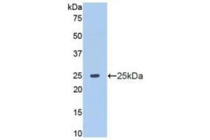 Detection of Recombinant MMP13, Human using Polyclonal Antibody to Matrix Metalloproteinase 13 (MMP13) (MMP13 抗体  (AA 103-290))