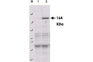Western blot using ROCK2 (phospho Y256) polyclonal antibody  shows detection of phosphorylated ROCK2 in transfected 293T cells. (ROCK2 抗体  (pTyr256))