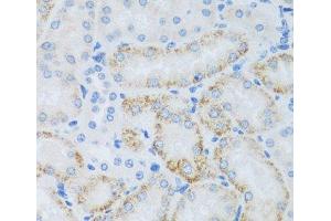 Immunohistochemistry of paraffin-embedded Mouse kidney using ASB4 Polyclonal Antibody at dilution of 1:100 (40x lens). (ASB4 抗体)