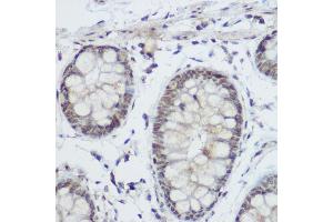Immunohistochemistry (IHC) image for anti-Zinc Finger and BTB Domain Containing 16 (ZBTB16) (AA 1-220) antibody (ABIN6150368)