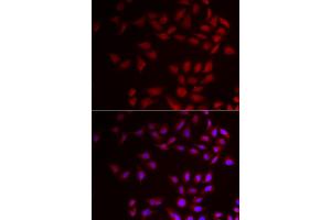 Immunofluorescence analysis of HeLa cells using CIRBP antibody (ABIN5973938). (CIRBP 抗体)