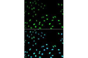 Immunofluorescence analysis of MCF-7 cells using RFC1 antibody. (RFC1 抗体)