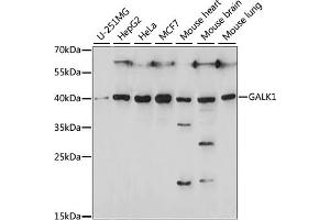 Western blot analysis of extracts of various cell lines, using G antibody (ABIN7267328) at 1:1000 dilution. (GALK1 抗体  (AA 1-120))
